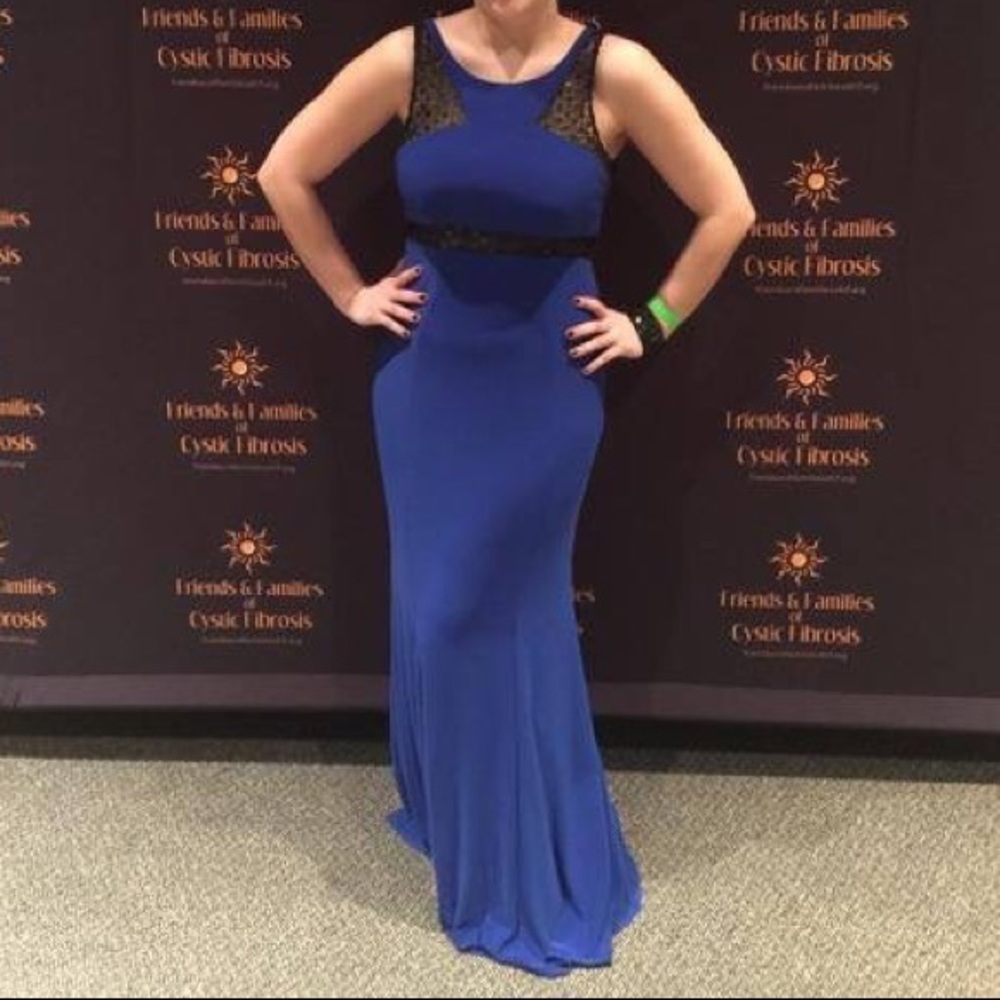 - Blue Cache dress with black lace detail cutouts